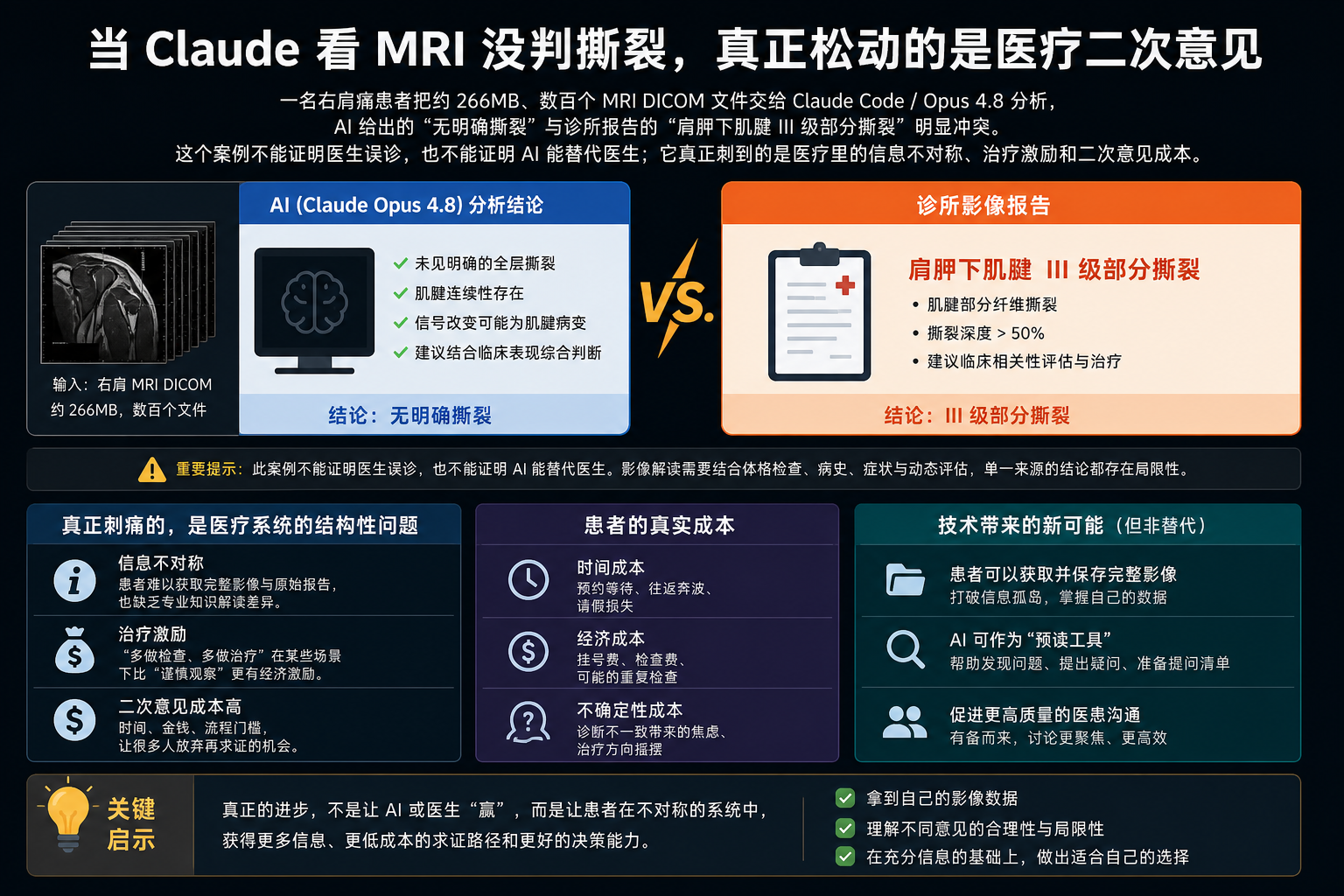 Claude 看 MRI 没判撕裂，真正松动的是医疗二次意见