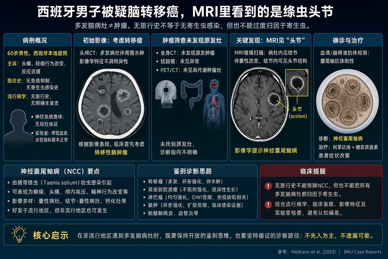 西班牙男子被疑脑转移癌，MRI里看到的是绦虫头节