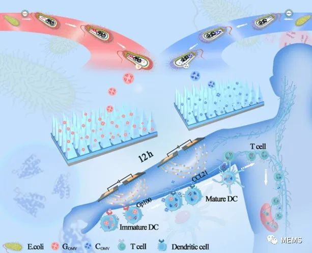 利用带电微针贴片实现疫苗接种 (https://ic.work/) 医疗电子 第1张