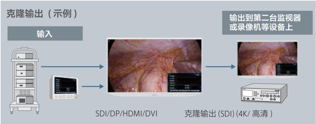 索尼推出一款高品质4K 2D 55英寸HDR医用液晶监视器-LMD-XH550MC (https://ic.work/) 医疗电子 第5张