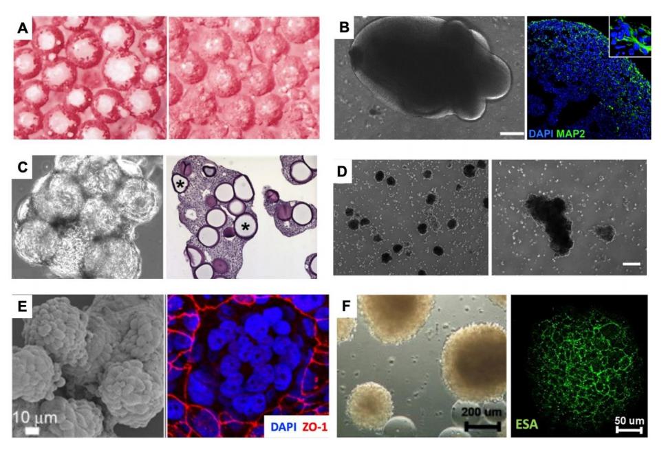 微重力下3D组织结构的生物制造及其在人体病理生理研究中的应用 (https://ic.work/) 医疗电子 第3张