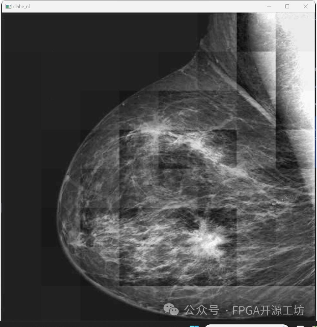 FPGA图像处理-CLAHE算法的第二步对比度限制(三) (https://ic.work/) 可编辑器件 第1张