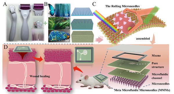 仿生超构微流控微针贴片，用于高效伤口管理 (https://ic.work/) 医疗电子 第1张