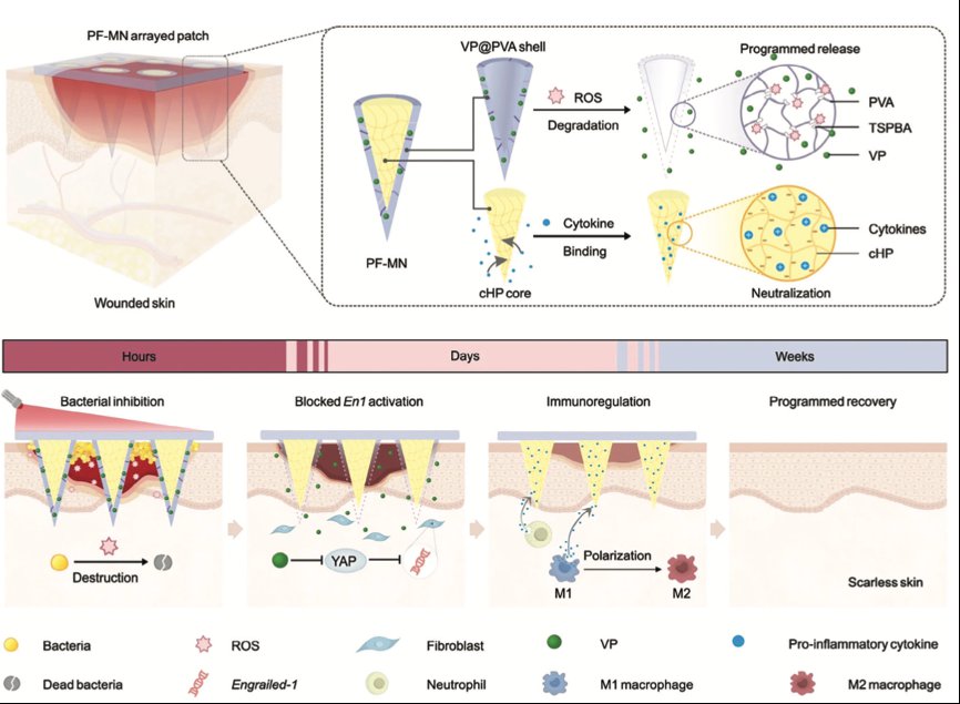 用于伤口和疤痕治疗的微针贴片研究进展 (https://ic.work/) 医疗电子 第6张