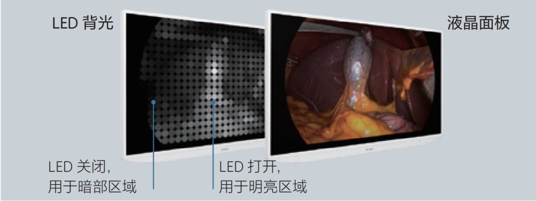 索尼推出一款高品质4K 2D 55英寸HDR医用液晶监视器-LMD-XH550MC (https://ic.work/) 医疗电子 第3张