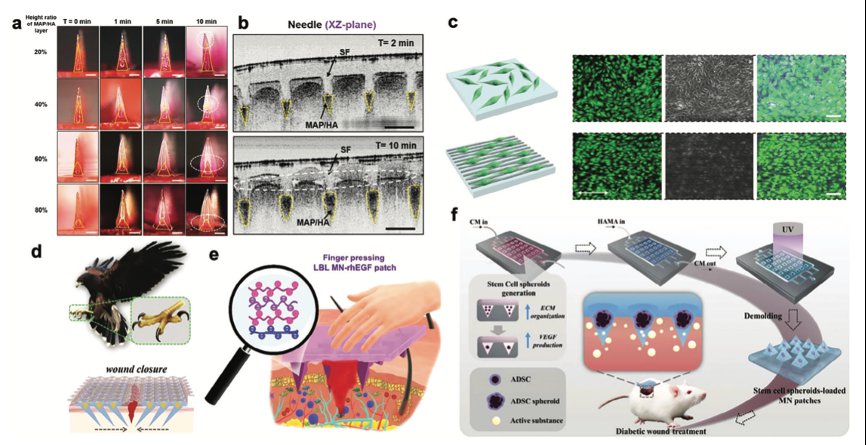 用于伤口和疤痕治疗的微针贴片研究进展 (https://ic.work/) 医疗电子 第2张