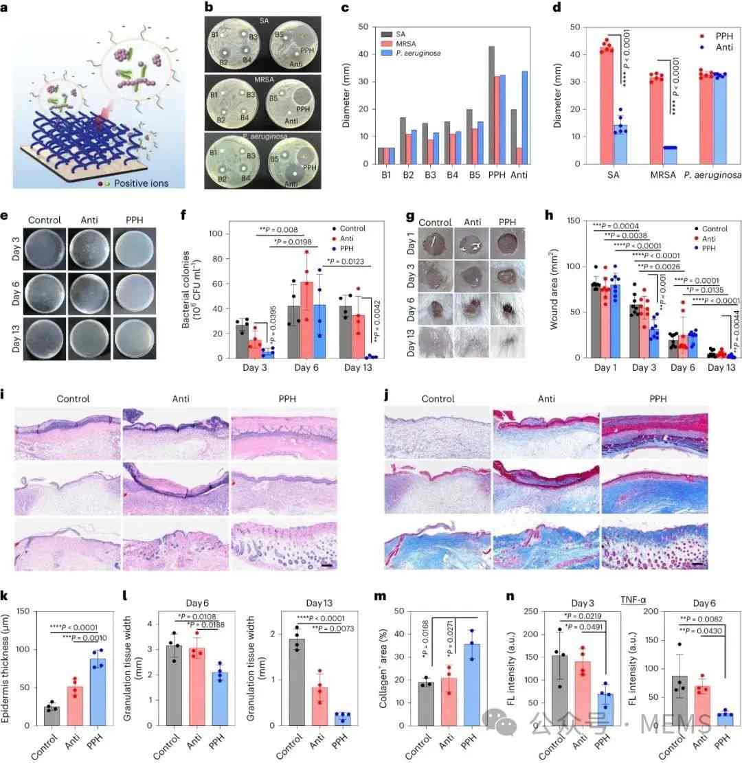 用于多功能表皮电子与心脏贴片的激光诱导可拉伸生物电子界面 (https://ic.work/) 医疗电子 第3张