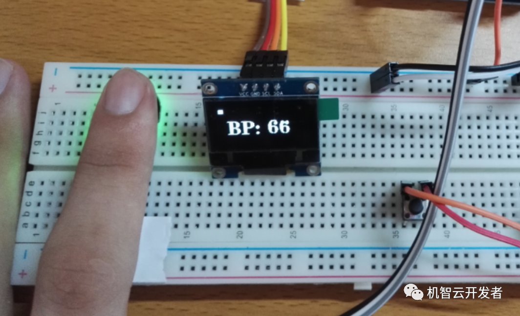 智能健康计，Arduino的再应用 (https://ic.work/) 医疗电子 第7张