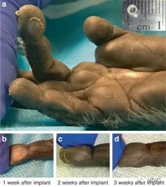 首款完全无线的植入式触觉传感器研发应用 (https://ic.work/) 传感器 第6张