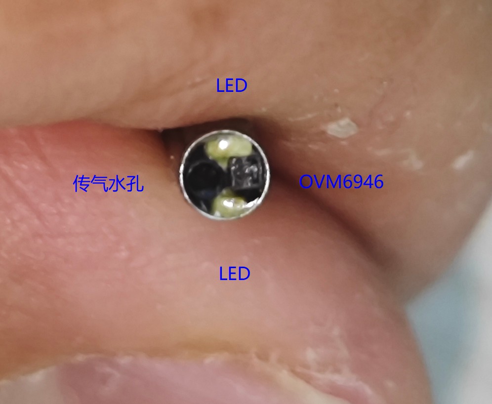 内窥镜FPGA技术深解：引领精准医疗，技术革新助力健康 (https://ic.work/) 可编辑器件 第7张