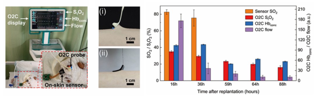 小型化表皮生物传感器用于术后血运状态持续监测 (https://ic.work/) 医疗电子 第3张