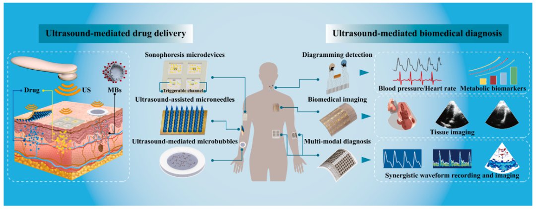 基于皮肤的超声激活微型器件在智能给药与诊断上的应用研究进展 (https://ic.work/) 医疗电子 第1张