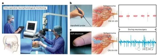 高集成度、微型无线生物电子设备助力实现健康监测 (https://ic.work/) 医疗电子 第6张