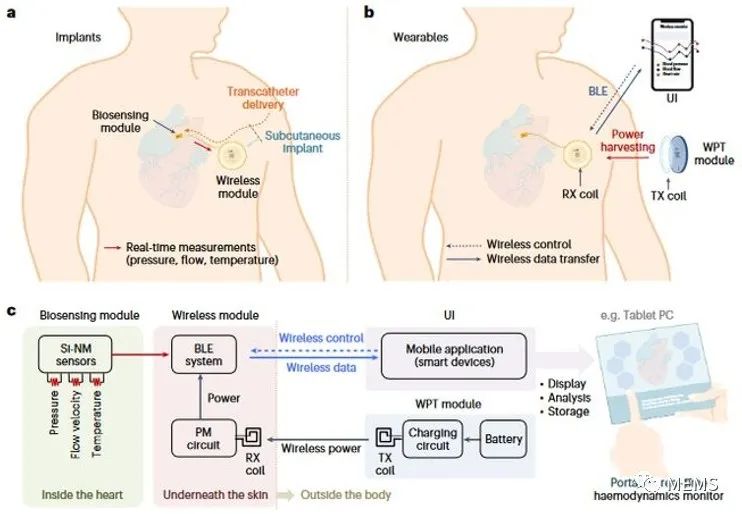 高集成度、微型无线生物电子设备助力实现健康监测 (https://ic.work/) 医疗电子 第1张