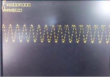 基于Digilent basys 3开发板的FPGA示波器设计 (https://ic.work/) 可编辑器件 第30张