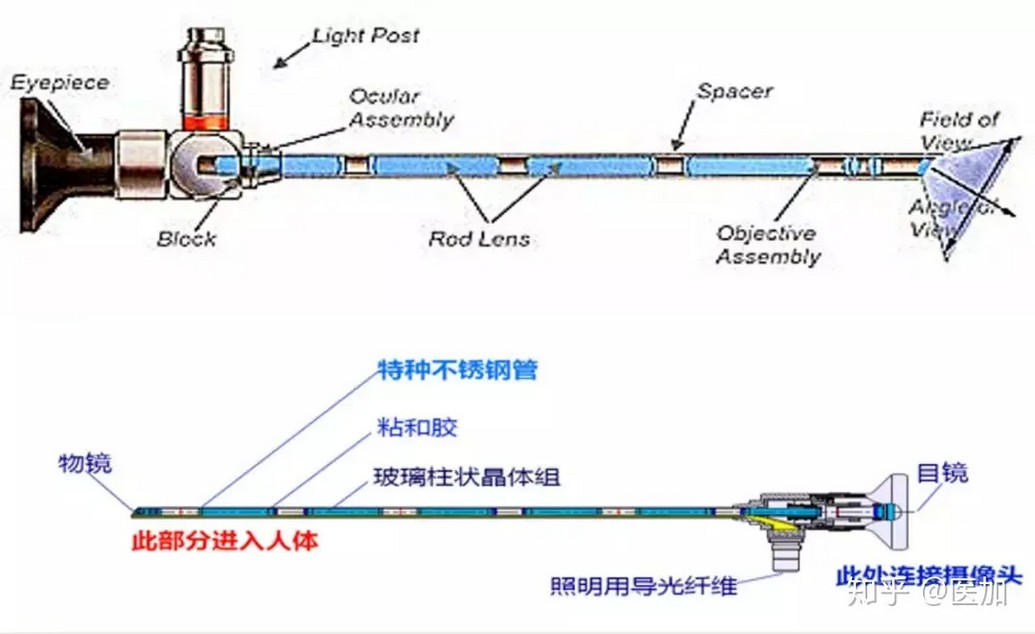 内窥镜软窥FPGA方案全解析，助力你轻松掌握前沿技术！ (https://ic.work/) 医疗电子 第3张