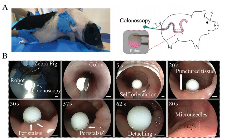 利用微针机器人实现结肠给药的快速自定位和抗蠕动粘附 (https://ic.work/) 医疗电子 第7张