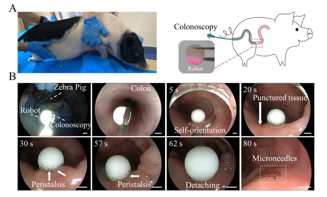 微针机器人实现结肠给药的快速自定位和抗蠕动粘附 (https://ic.work/) 医疗电子 第7张