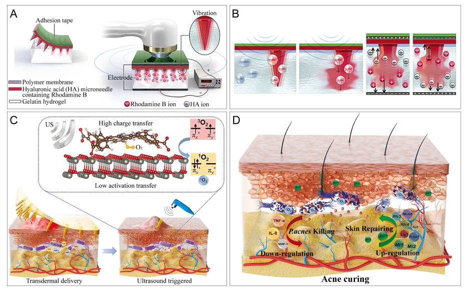 基于皮肤的超声激活微型器件在智能给药与诊断上的应用研究进展 (https://ic.work/) 医疗电子 第2张