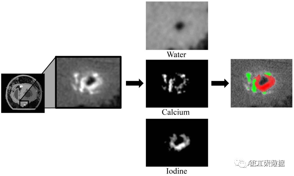 医学影像诊断的未来：数字平板探测器技术 (https://ic.work/) 医疗电子 第8张